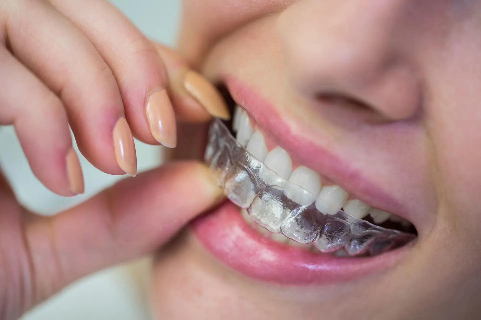 Orthodontics