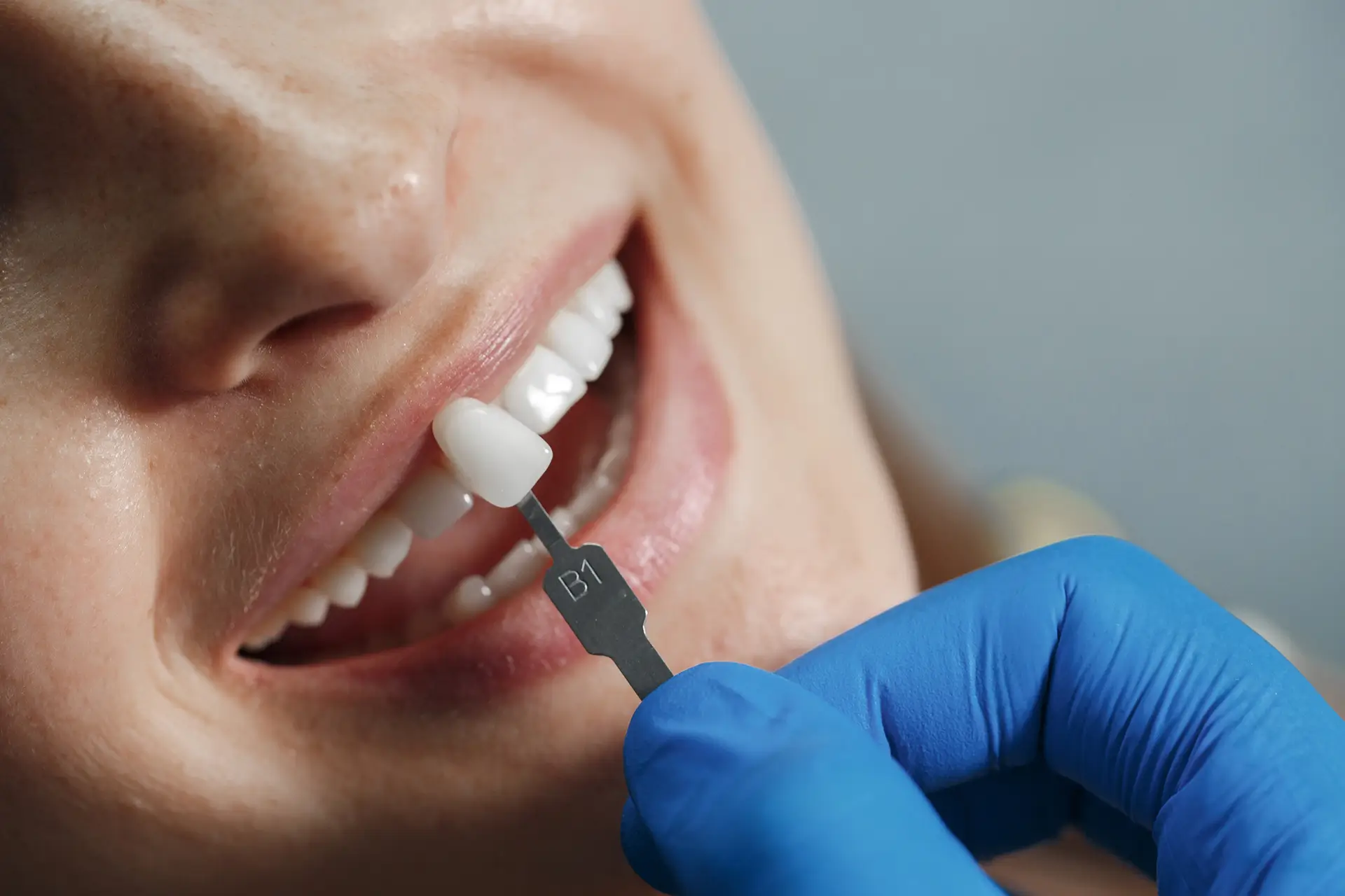 Implants