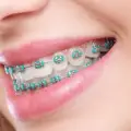 Orthodontic Treatment: Better Alignment, Function, and Oral Health