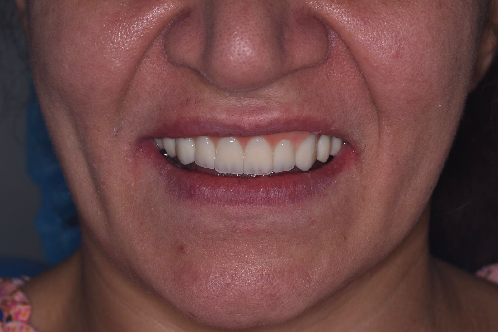 After